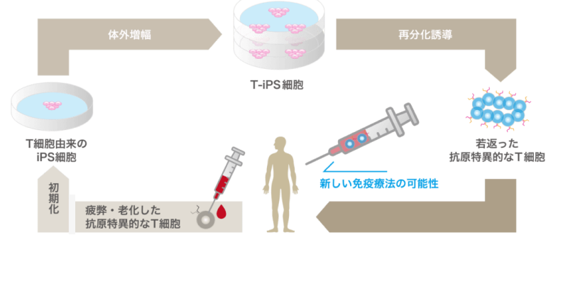iPS Private Bankとは?